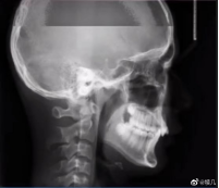 1562231963833267.png image.png